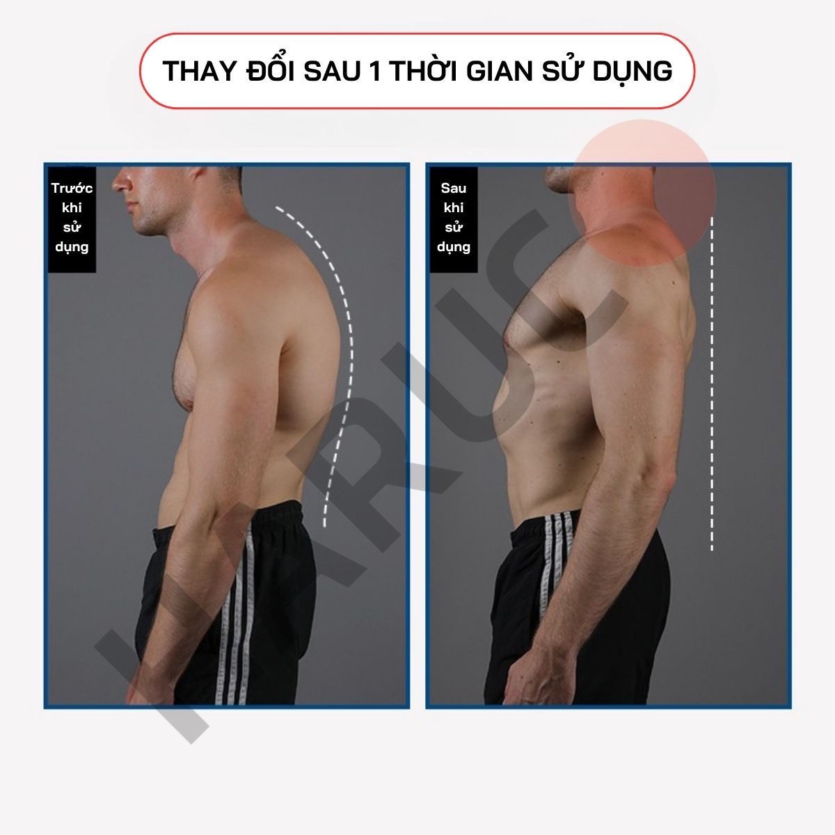 Đai Lưng Chống Gù Cao Cấp Haruco HRC-06-8