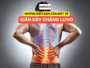 Những điều bạn cần biết về giãn dây chằng lưng