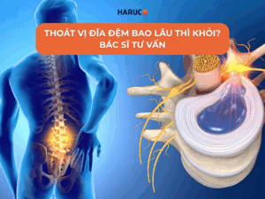 Thoát vị đĩa đệm bao lâu thì khỏi? Giải đáp từ chuyên gia