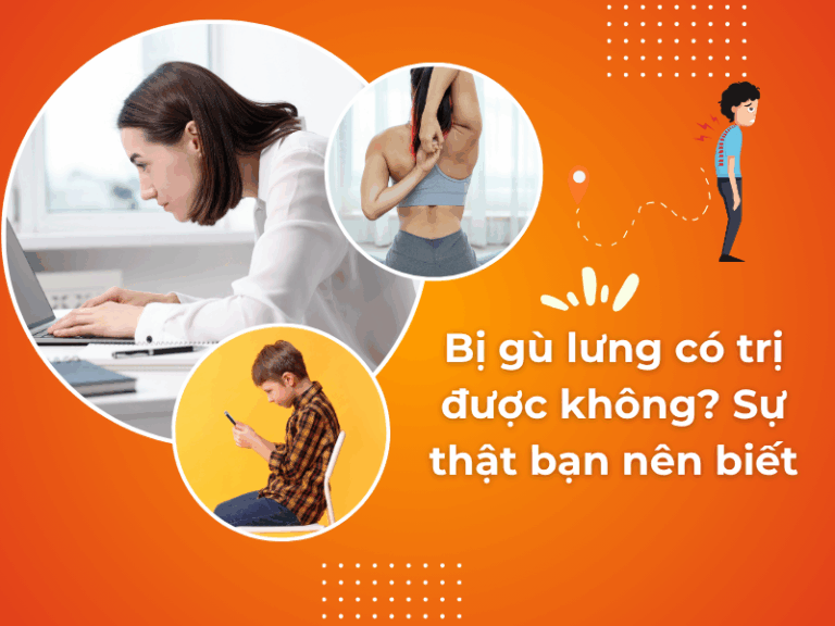 Bị gù lưng có trị được không? Sự thật bạn nên biết