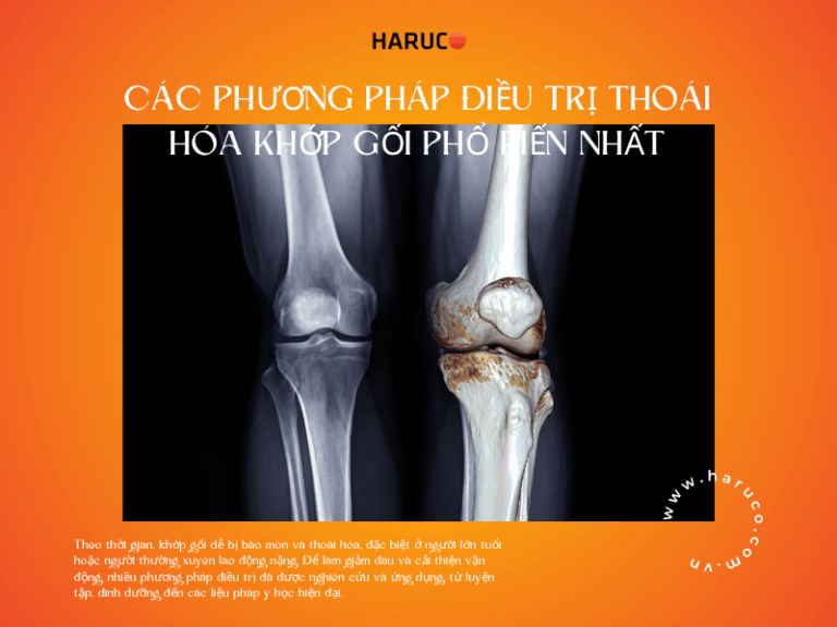 Tổng hợp các phương pháp điều trị thoái hóa khớp gối hiệu quả
