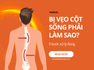 Bị vẹo cột sống phải làm sao? 5 bước xử lý đúng