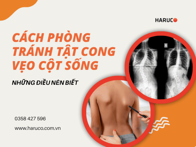 Cách phòng tránh tật cong vẹo cột sống: Những điều nên biết