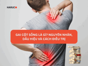 Gai cột sống là gì? Tìm hiểu nguyên nhân, dấu hiệu và cách điều trị