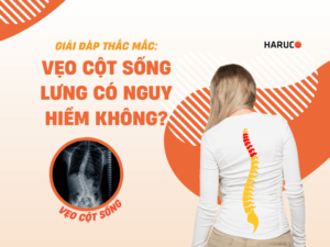 Giải đáp thắc mắc: Vẹo cột sống lưng có nguy hiểm không?