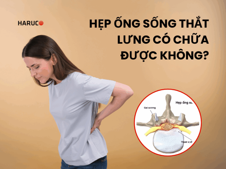 Hẹp ống sống thắt lưng có chữa được không? Cách kiểm soát hiệu quả