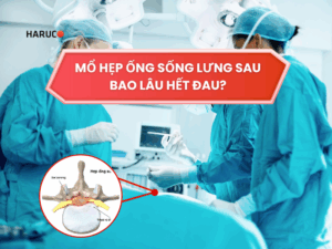 Mổ hẹp ống sống lưng sau bao lâu hết đau? Giải đáp chi tiết