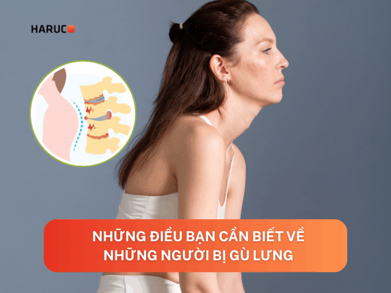 Những người bị gù lưng: Nguyên nhân và cách cải thiện
