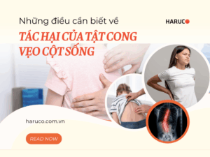 Những điều cần biết về tác hại của tật cong vẹo cột sống