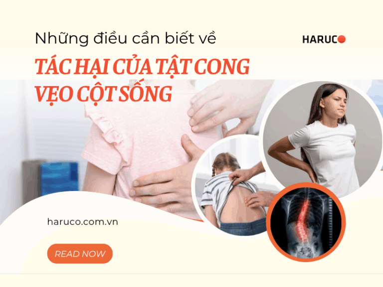 Những điều cần biết về tác hại của tật cong vẹo cột sống