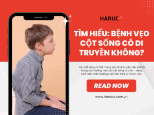 Tìm hiểu: Bệnh vẹo cột sống có di truyền không?