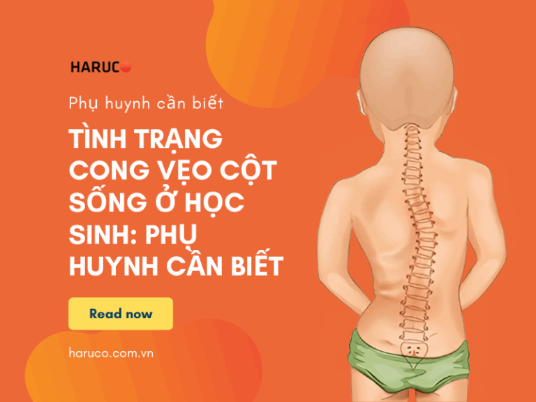 Tình trạng cong vẹo cột sống ở học sinh: Phụ huynh cần biết