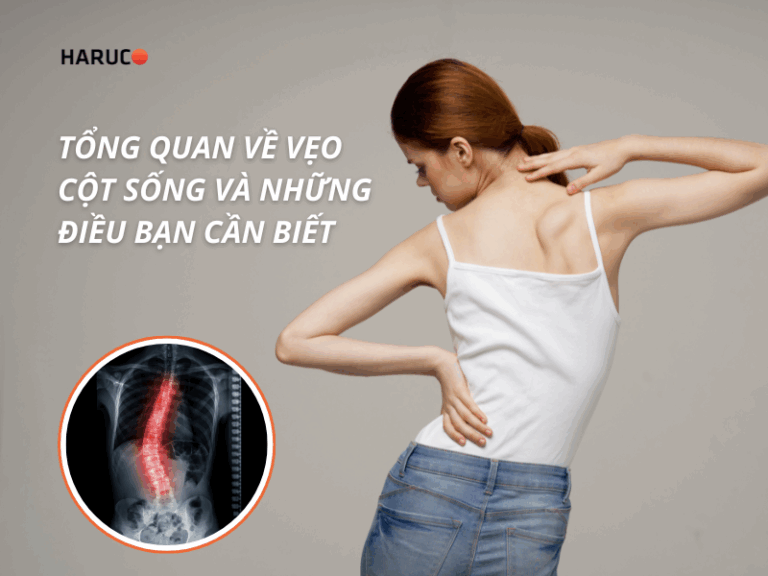 Tổng quan về vẹo cột sống và những điều bạn cần biết