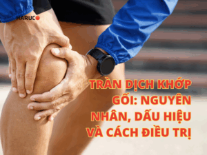 Tràn dịch khớp gối: Nguyên nhân, dấu hiệu và phương pháp điều trị