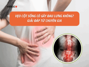 Vẹo cột sống có gây đau lưng không? Giải đáp từ chuyên gia