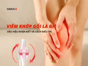 Viêm khớp gối là gì? Dấu hiệu nhận biết và phương pháp điều trị