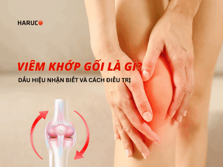 Viêm khớp gối là gì? Dấu hiệu nhận biết và phương pháp điều trị