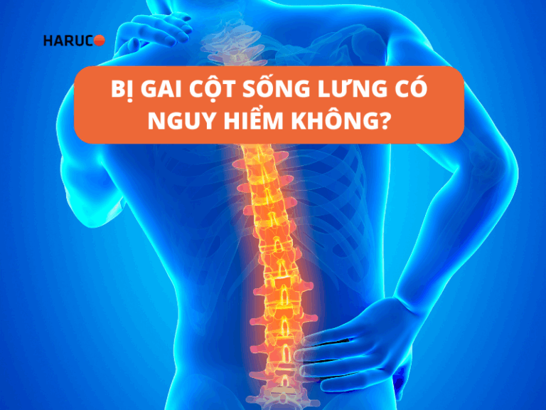 Bị gai cột sống lưng có nguy hiểm không?