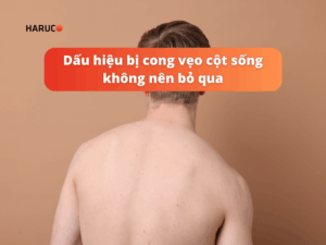 Dấu hiệu bị cong vẹo cột sống không nên bỏ qua