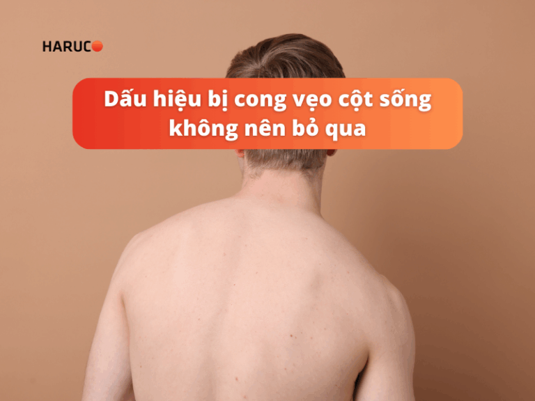 Dấu hiệu bị cong vẹo cột sống không nên bỏ qua