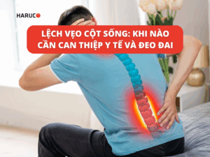 Lệch vẹo cột sống: Khi nào cần can thiệp y tế và đeo đai