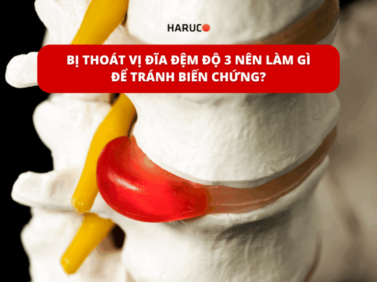 Bị thoát vị đĩa đệm độ 3 nên làm gì để tránh biến chứng?