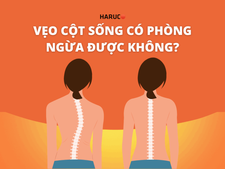 Vẹo cột sống có phòng ngừa được không?
