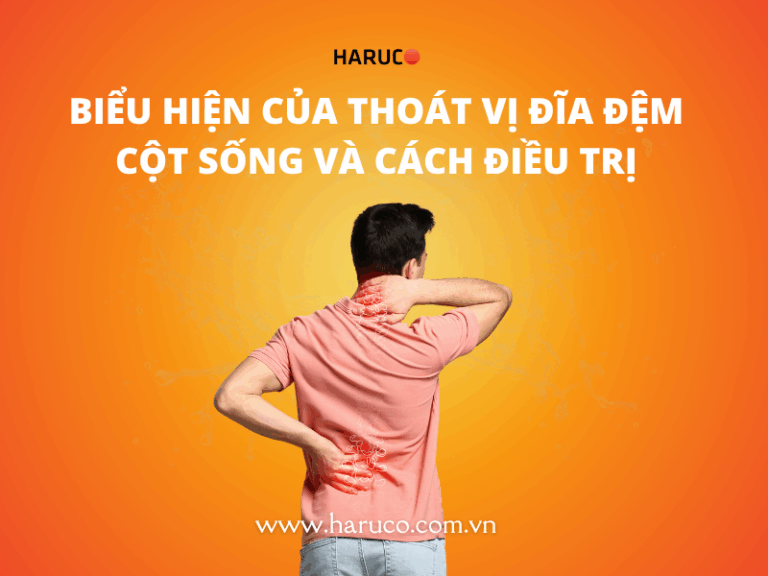 Biểu hiện của thoát vị đĩa đệm cột sống và cách điều trị