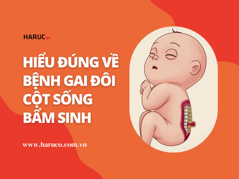 Gai đôi cột sống bẩm sinh: Phát hiện sớm để điều trị hiệu quả