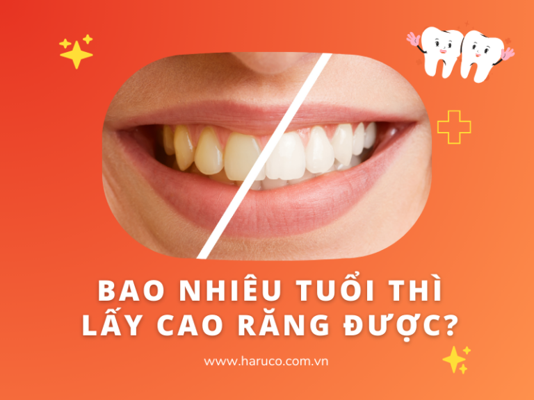Bao nhiêu tuổi thì lấy cao răng được? Cần lưu ý điều gì?