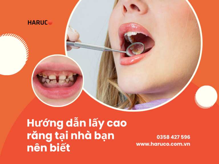 Hướng dẫn lấy cao răng tại nhà đơn giản và hiệu quả bạn nên biết