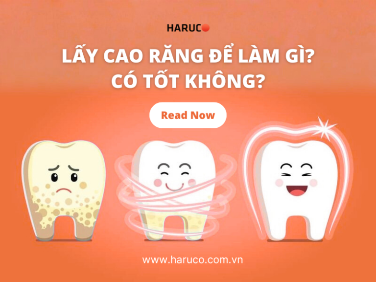 Lấy cao răng để làm gì? Khi nào bạn cần lấy cao răng?