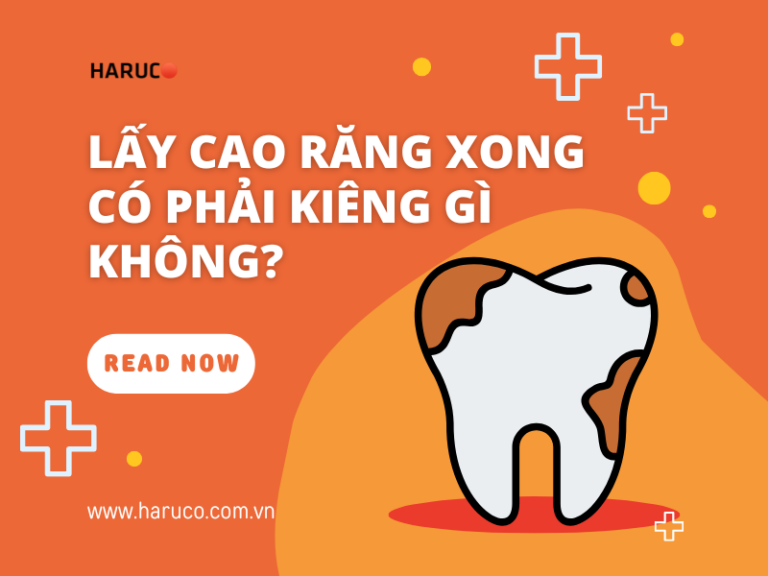 Lấy cao răng xong có phải kiêng gì không? Các lưu ý quan trọng