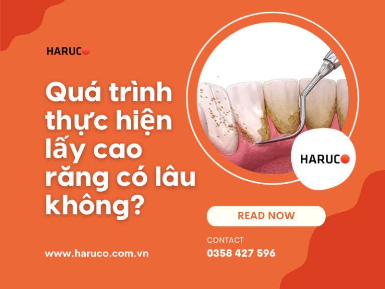 Lấy cao răng có lâu không? 5 câu hỏi thường gặp khi lấy cao răng