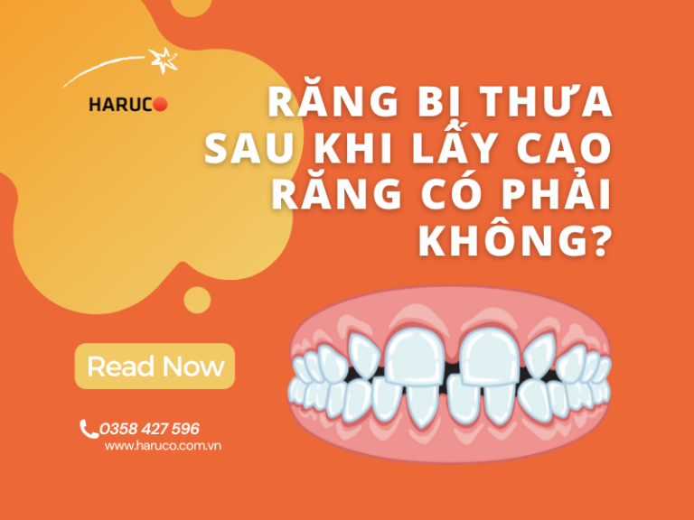 Răng bị thưa sau khi lấy cao răng có phải không?