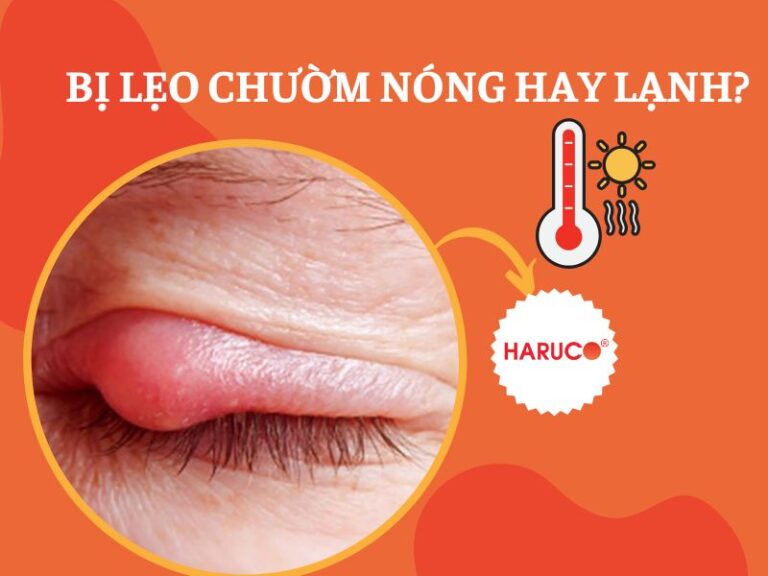 Bị lẹo chườm nóng hay lạnh để giảm đau, giảm sưng hiệu quả