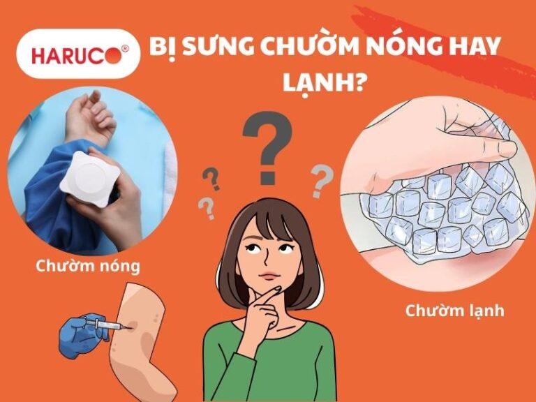Bị sưng chườm nóng hay lạnh? Những điều cần biết