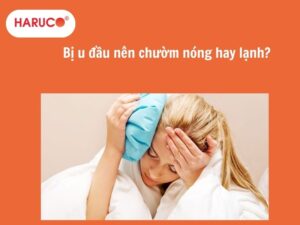 Bị u đầu nên chườm nóng hay lạnh để nhanh tan máu bầm?