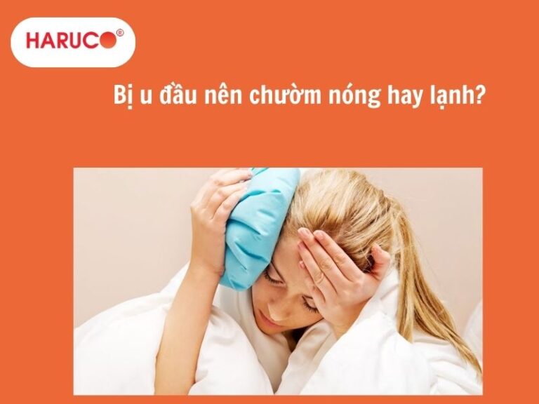 Bị u đầu nên chườm nóng hay lạnh để nhanh tan máu bầm?