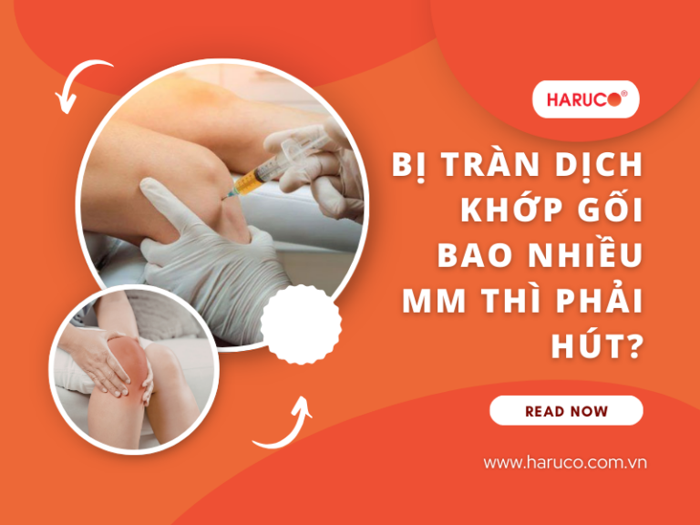 Bị tràn dịch khớp gối bao nhiêu mm thì phải hút?