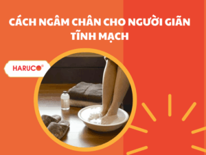 Hướng dẫn cách ngâm chân cho người giãn tĩnh mạch