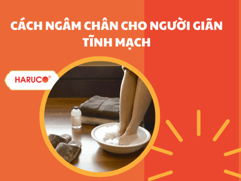 Hướng dẫn cách ngâm chân cho người giãn tĩnh mạch