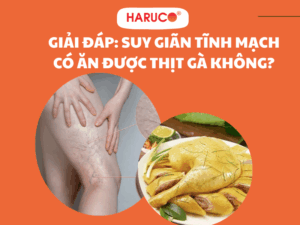 Giải đáp: Suy giãn tĩnh mạch có ăn được thịt gà không?