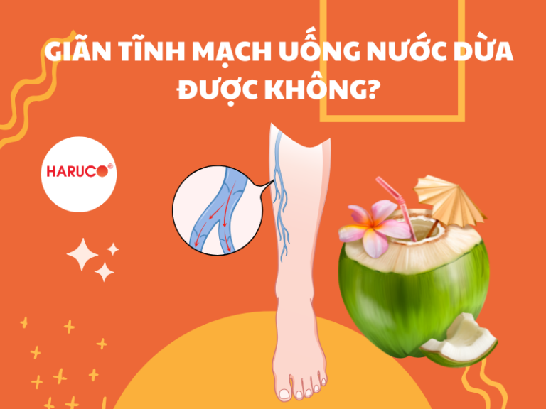 Thắc mắc: Giãn tĩnh mạch uống nước dừa được không?
