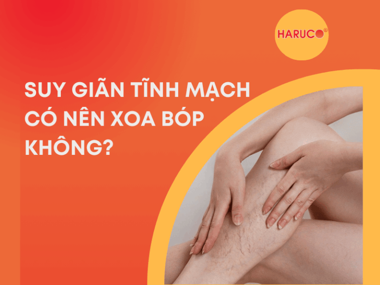 Suy giãn tĩnh mạch có nên xoa bóp không?